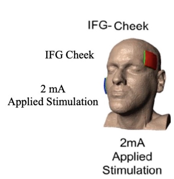 tDCS-sham